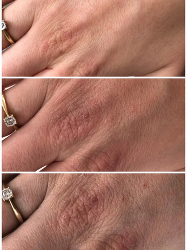 swederm Hudsalva vit E - ointment for dry skin